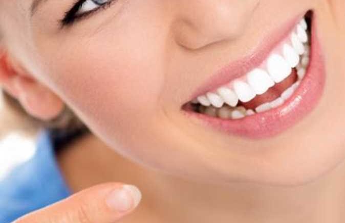 riavere uno splendido sorriso